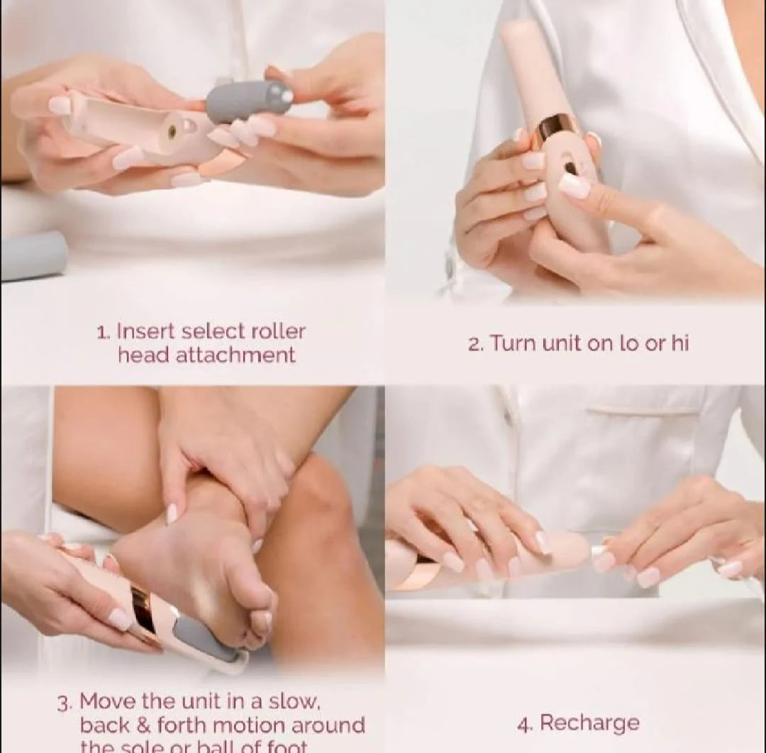 Electric Foot Callus Remover – Pedicure File for Cracked Heels