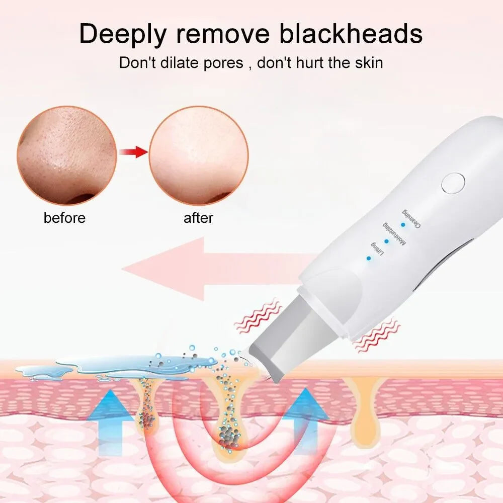 Ultrasonic Skin Scrubber Deep Face Cleaning Machine, Remove Dirt & Blackhead
