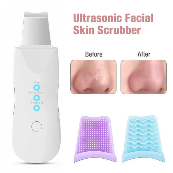 Ultrasonic Skin Scrubber Deep Face Cleaning Machine, Remove Dirt & Blackhead