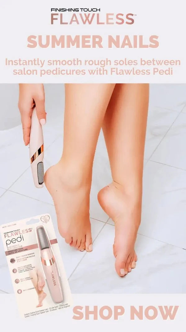 Electric Foot Callus Remover – Pedicure File for Cracked Heels