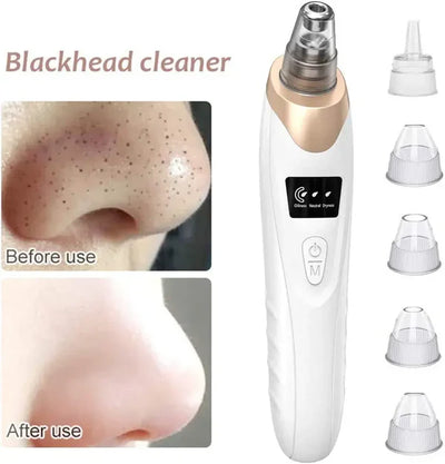 Blackhead Remover | 5-in-1 Deep Pore Cleansing Tool