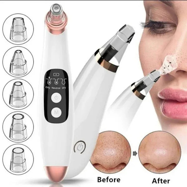 Blackhead Remover | 5-in-1 Deep Pore Cleansing Tool